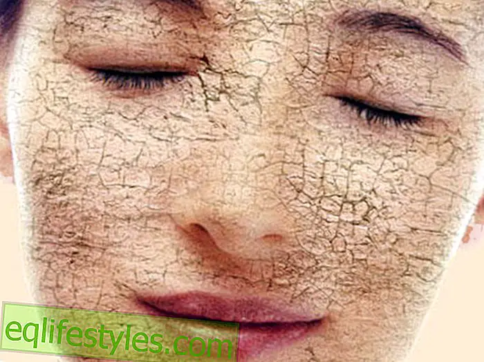 الجمال: الجلد الجاف 5 الأشياء التي تحدث إذا لم ترطب بشرتك