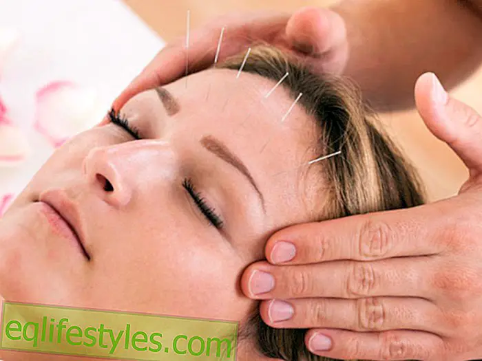 Healthy - Does acupuncture help against wrinkles?