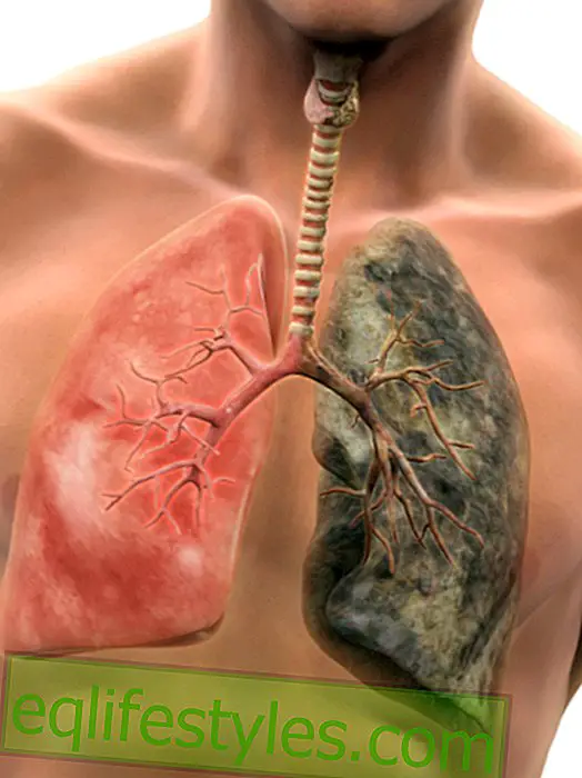 Αυτές είναι οι 5 πιο θανατηφόρες ασθένειες καπνίσματος