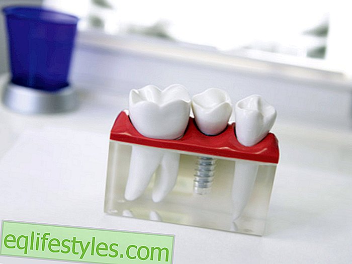 sund - Hvor sikkert bruges tandimplantater?