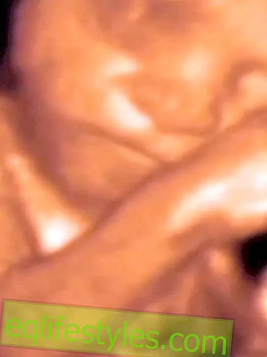 Uskomaton 3D-video: Vauva kohdussa