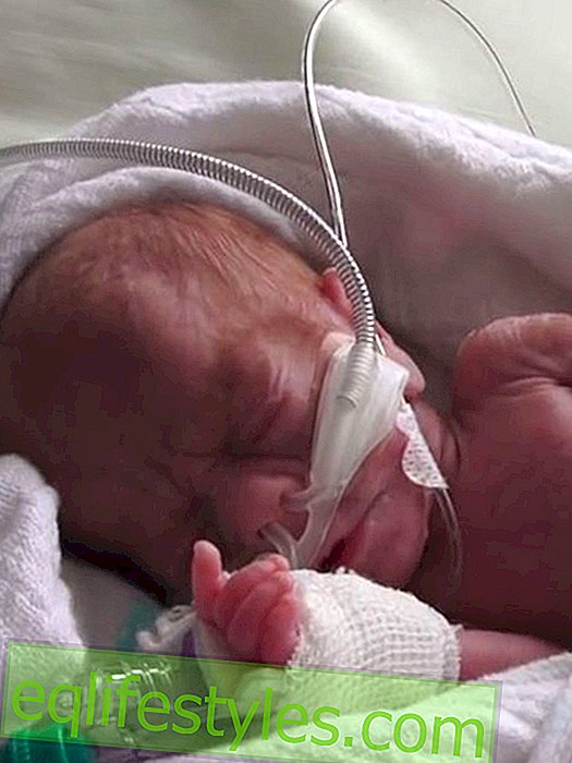 PrematurityBorn in the 26th week of pregnancy: These twins are a small miracle!