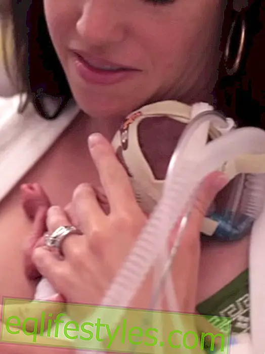 Touching video: The first year of a premature baby