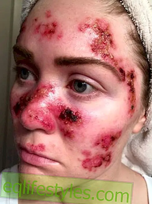 Αμερικανική γυναίκα σοκ με καρκίνο του δέρματος selfie