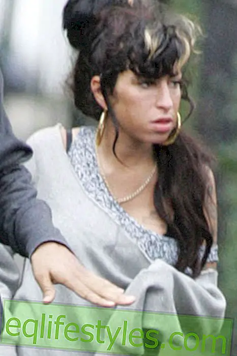 Amy Winehouse bruises her chest
