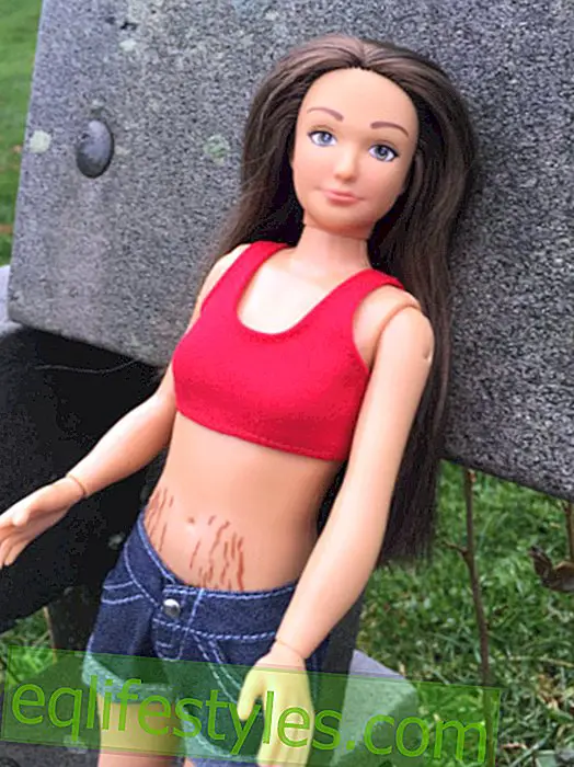 Freckles, selluliitti, akne: Tämä on uusi 'normaali' Barbie