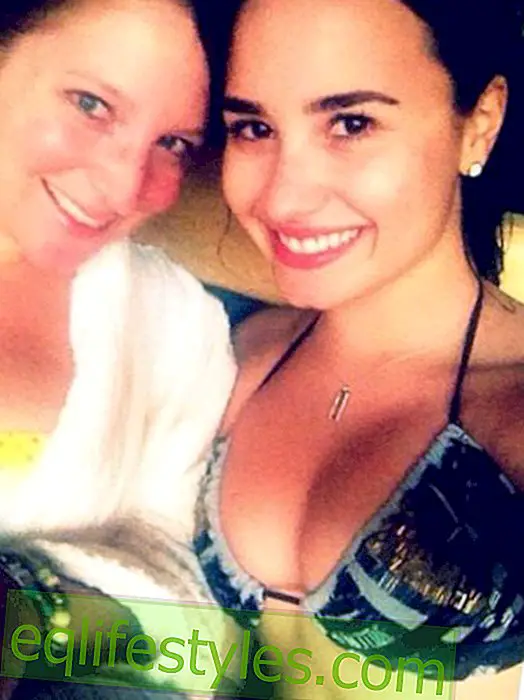 Η Demi Lovato φοράει με υπερηφάνεια τις ουλές της, όπως μια πληγή μάχης