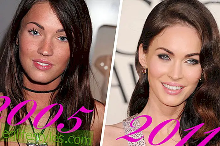 Las cirugías de belleza de Megan Fox