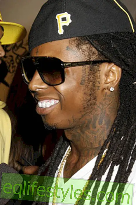 Досадното стоматологично лечение на Lil Wayne